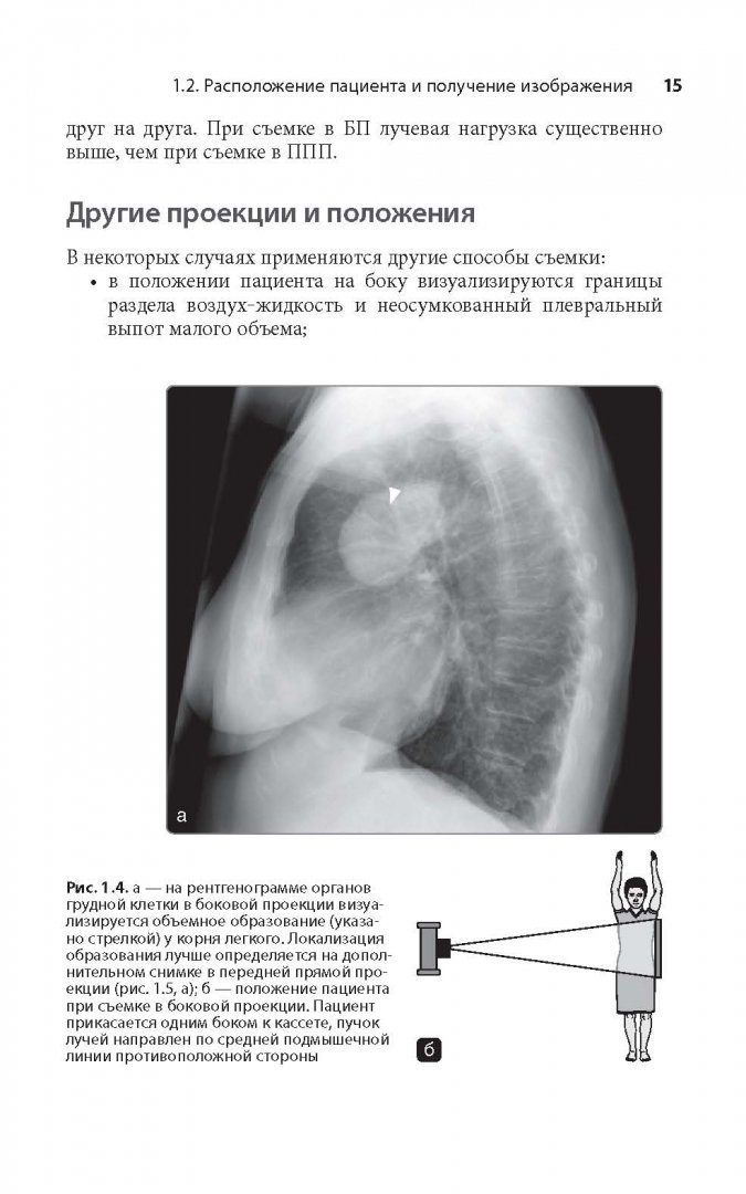Иллюстрация 7 из 22 для Клиническая интерпретация рентгенограммы легких - Дарби, Эди, Чендрейтриа | Лабиринт - книги. Источник: Лабиринт