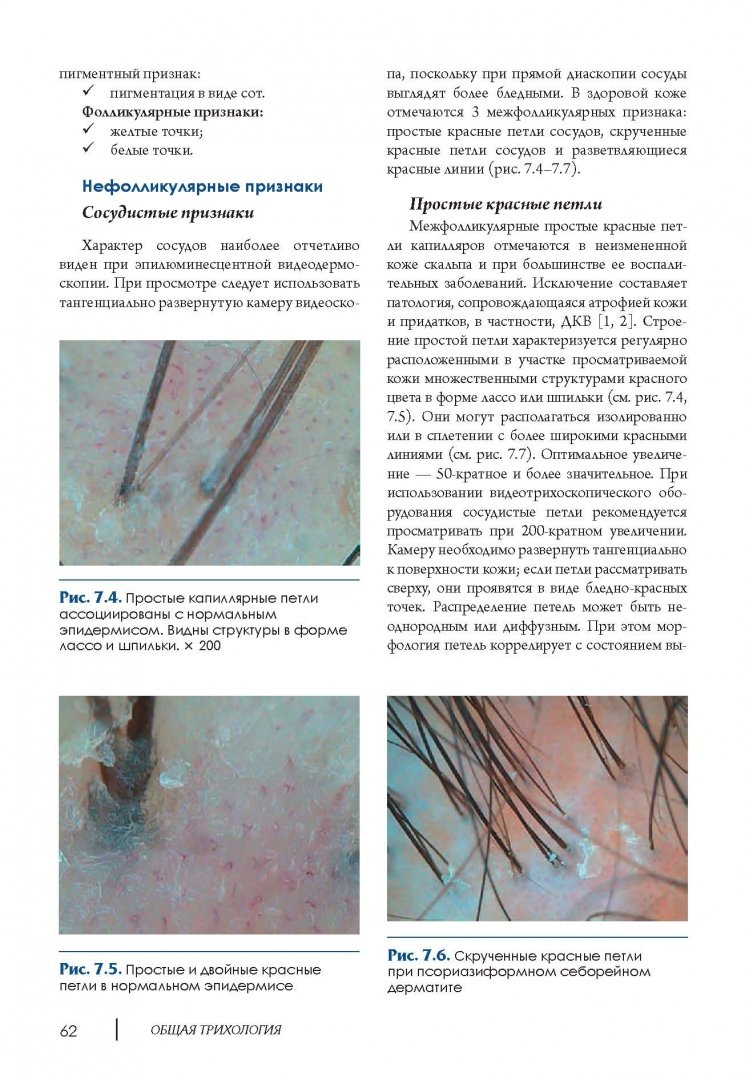 Иллюстрация 6 из 17 для Клиническая трихология - Аида Гаджигороева | Лабиринт - книги. Источник: Лабиринт
