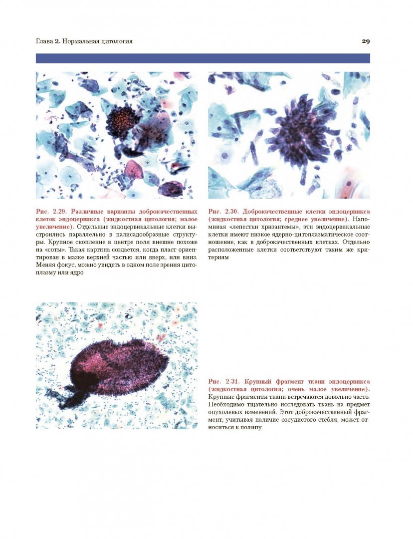 Иллюстрация 15 из 16 для Цитологические исследование цервикальных мазков. Атлас - Ванденбуш, Али, Розенталь, Ванг | Лабиринт - книги. Источник: Лабиринт