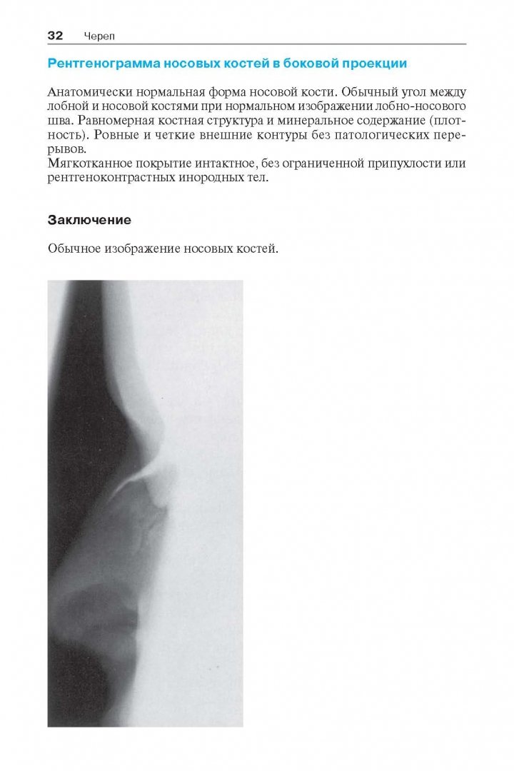 Иллюстрация 22 из 30 для Норма при рентгенологических исследованиях - Торстен Меллер | Лабиринт - книги. Источник: Лабиринт