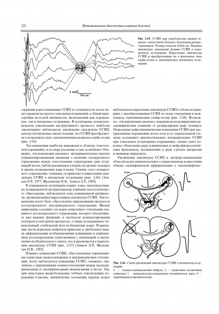 Иллюстрация 16 из 22 для Функциональная диагностика нервных болезней - Зенков, Ронкин | Лабиринт - книги. Источник: Лабиринт
