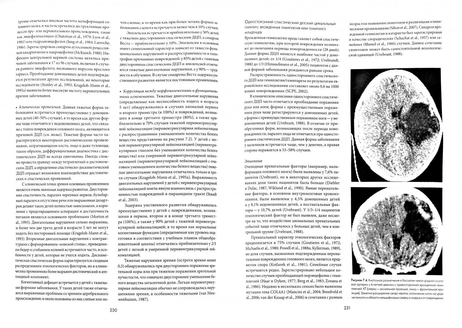 Иллюстрация 1 из 16 для Заболевания нервной системы у детей. В 2-х томах. Том 1 - Жан Айкарди | Лабиринт - книги. Источник: Лабиринт