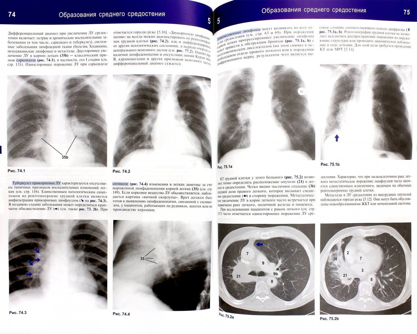 Иллюстрация 1 из 32 для Рентгенологическое исследование грудной клетки. Практическое руководство - Матиас Хофер | Лабиринт - книги. Источник: Лабиринт