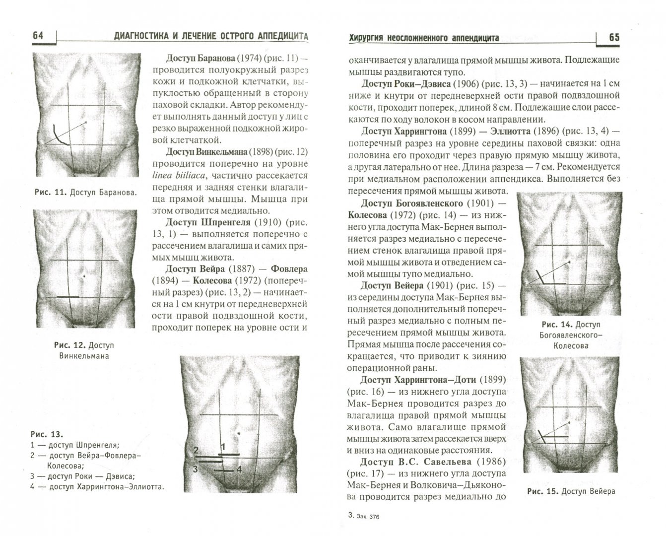 Иллюстрация 1 из 4 для Диагностика и лечение острого аппендицита - Сергей Фомин | Лабиринт - книги. Источник: Лабиринт