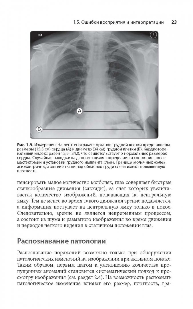 Иллюстрация 13 из 22 для Клиническая интерпретация рентгенограммы легких - Дарби, Эди, Чендрейтриа | Лабиринт - книги. Источник: Лабиринт