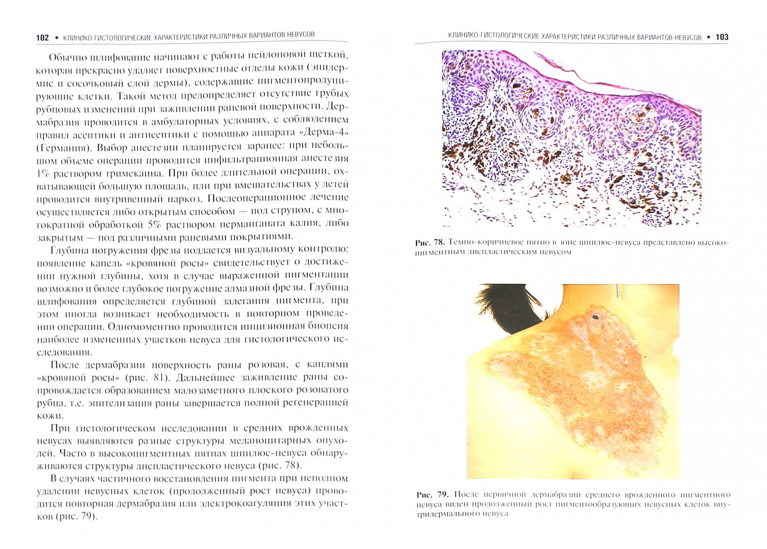 Иллюстрация 1 из 5 для Пигментные опухоли кожи - Лариса Червонная | Лабиринт - книги. Источник: Лабиринт