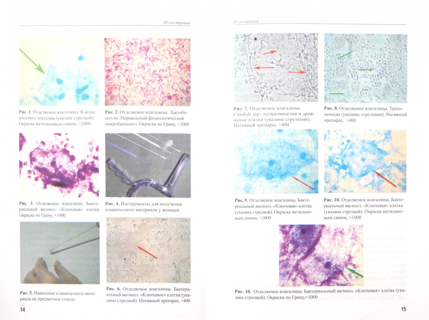 Иллюстрация 1 из 4 для Лабораторная диагностика бактериального вагиноза. Методические рекомендации - Савичева, Башмакова, Красносельских | Лабиринт - книги. Источник: Лабиринт