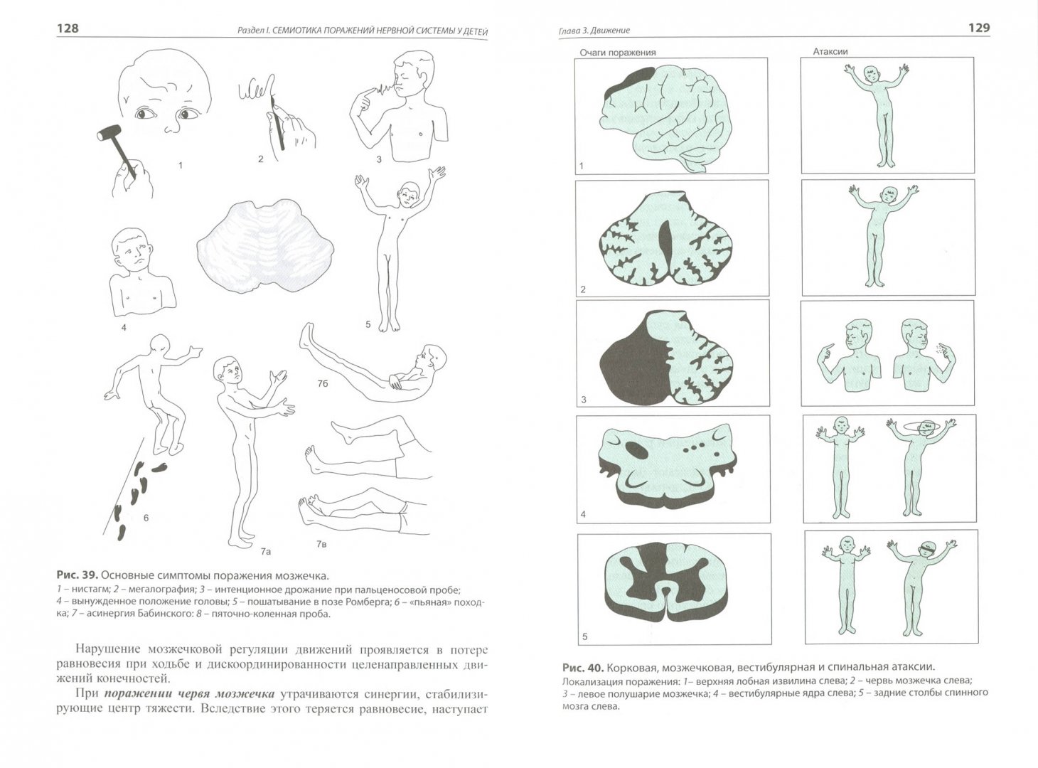 Иллюстрация 1 из 3 для Детская неврология - Левон Бадалян | Лабиринт - книги. Источник: Лабиринт