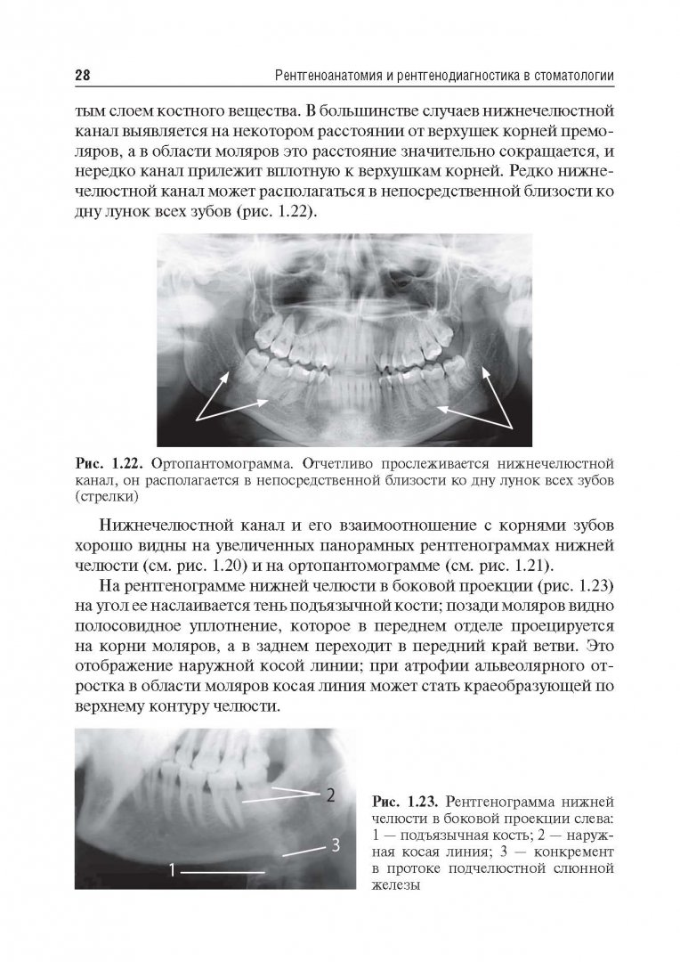 Иллюстрация 17 из 24 для Рентгеноанатомия и рентгенодиагностика в стоматологии - Виктор Трутень | Лабиринт - книги. Источник: Лабиринт