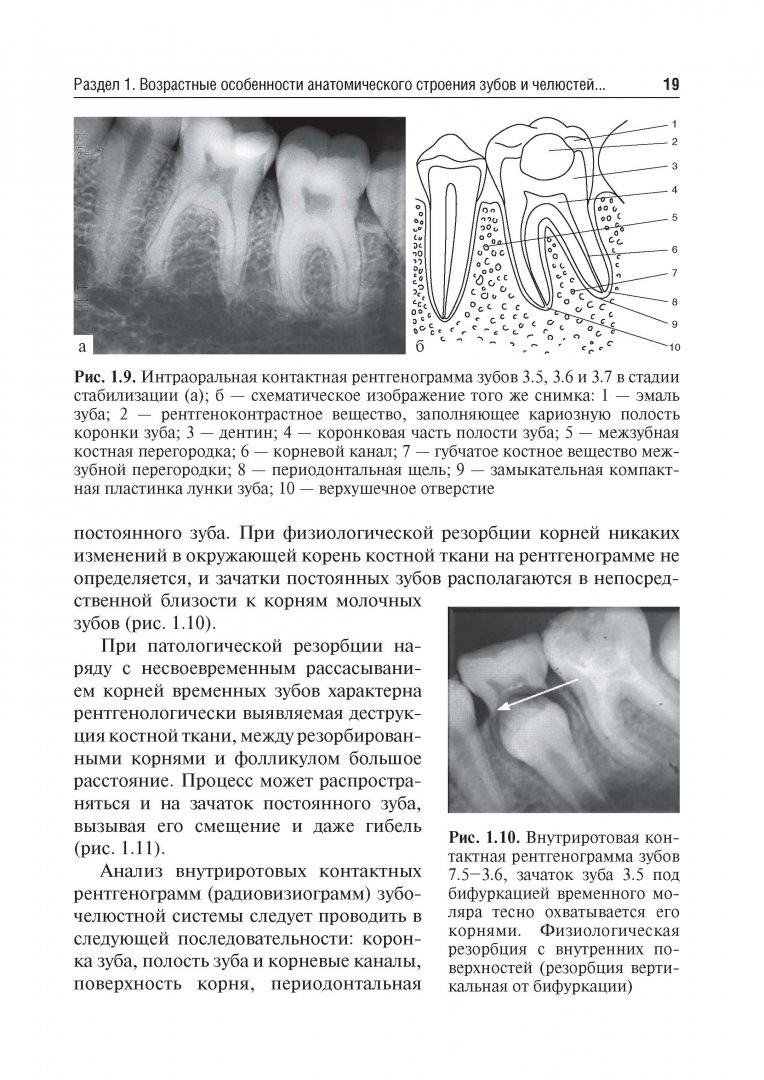 Иллюстрация 11 из 24 для Рентгеноанатомия и рентгенодиагностика в стоматологии - Виктор Трутень | Лабиринт - книги. Источник: Лабиринт