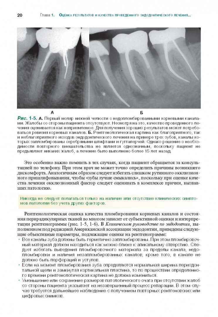 Иллюстрация 10 из 26 для Решение проблем в эндодонтии. Профилактика, диагностика и лечение - Гуиман, Думша, Ловдэл | Лабиринт - книги. Источник: Лабиринт