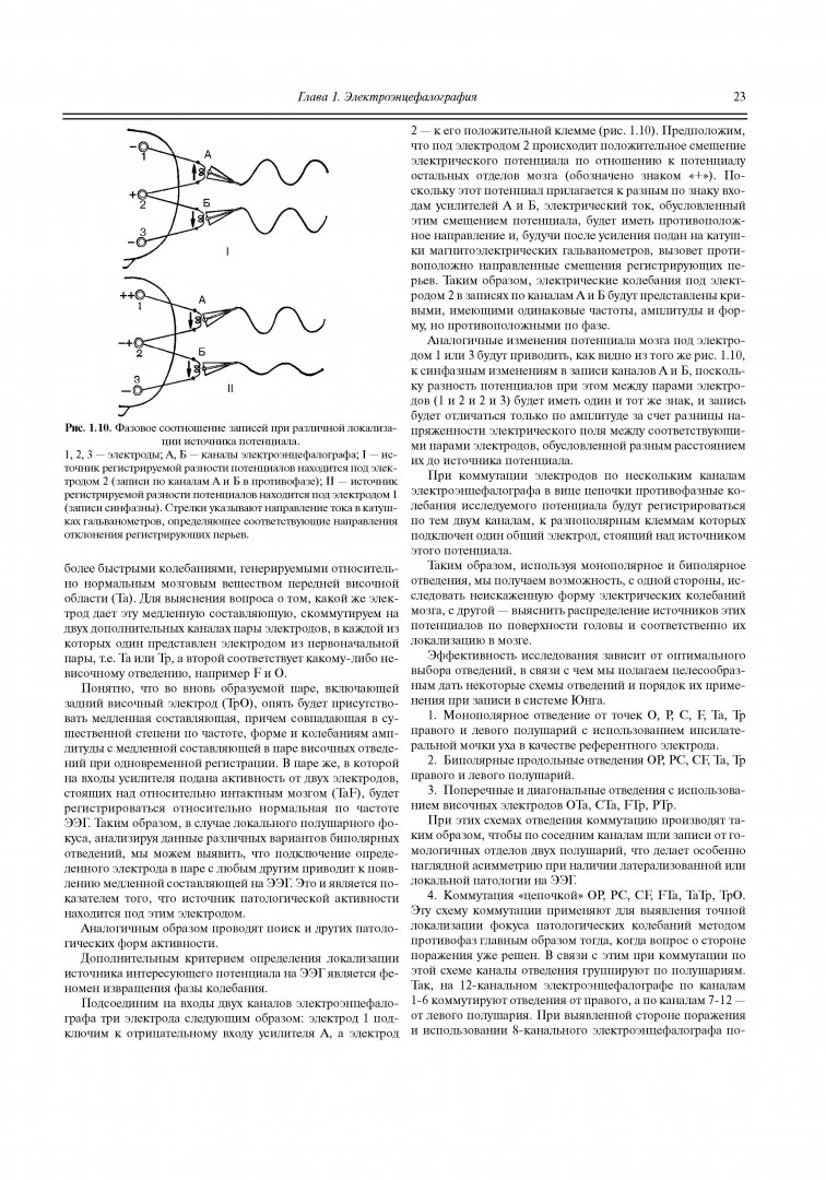 Иллюстрация 12 из 22 для Функциональная диагностика нервных болезней - Зенков, Ронкин | Лабиринт - книги. Источник: Лабиринт