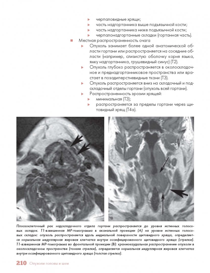 Иллюстрация 7 из 21 для Методы визуализации в онкологии. Стандарты описания опухолей. Цветной атлас - Хричак, Хасбанд, Паничек | Лабиринт - книги. Источник: Лабиринт