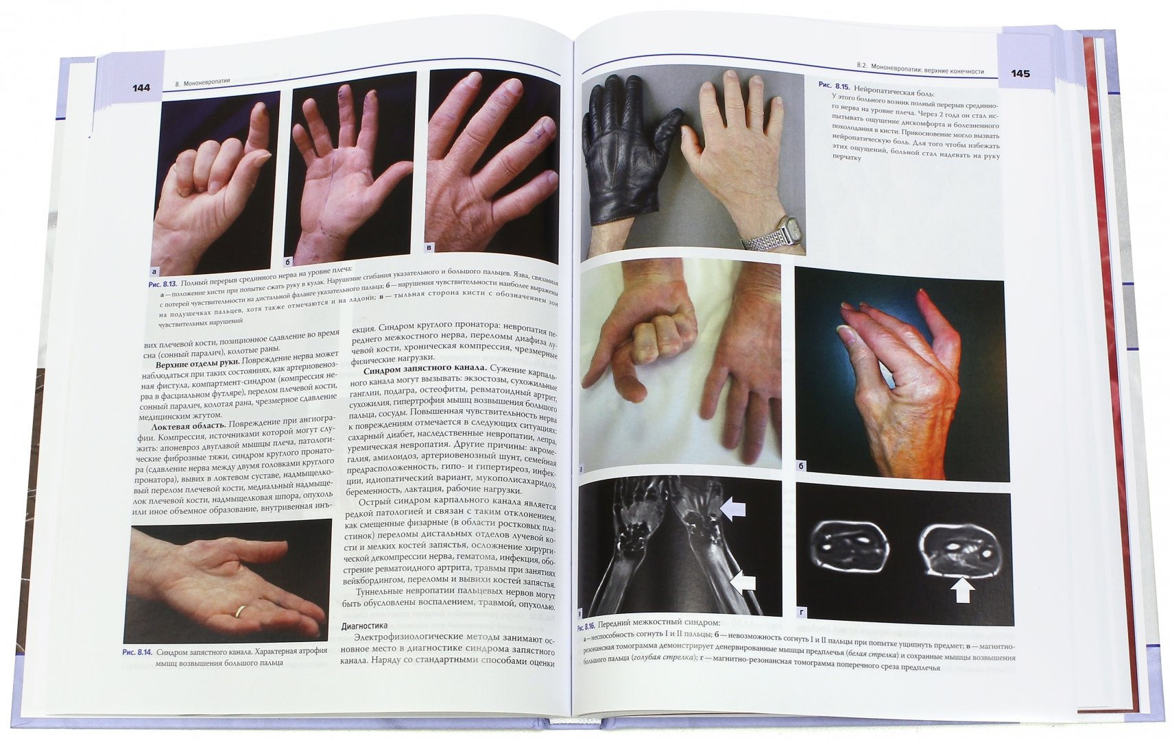 Иллюстрация 1 из 2 для Атлас нервно-мышечных болезней. Практическое руководство - Фельдман, Гризольд, Расселл, Лешер | Лабиринт - книги. Источник: Лабиринт