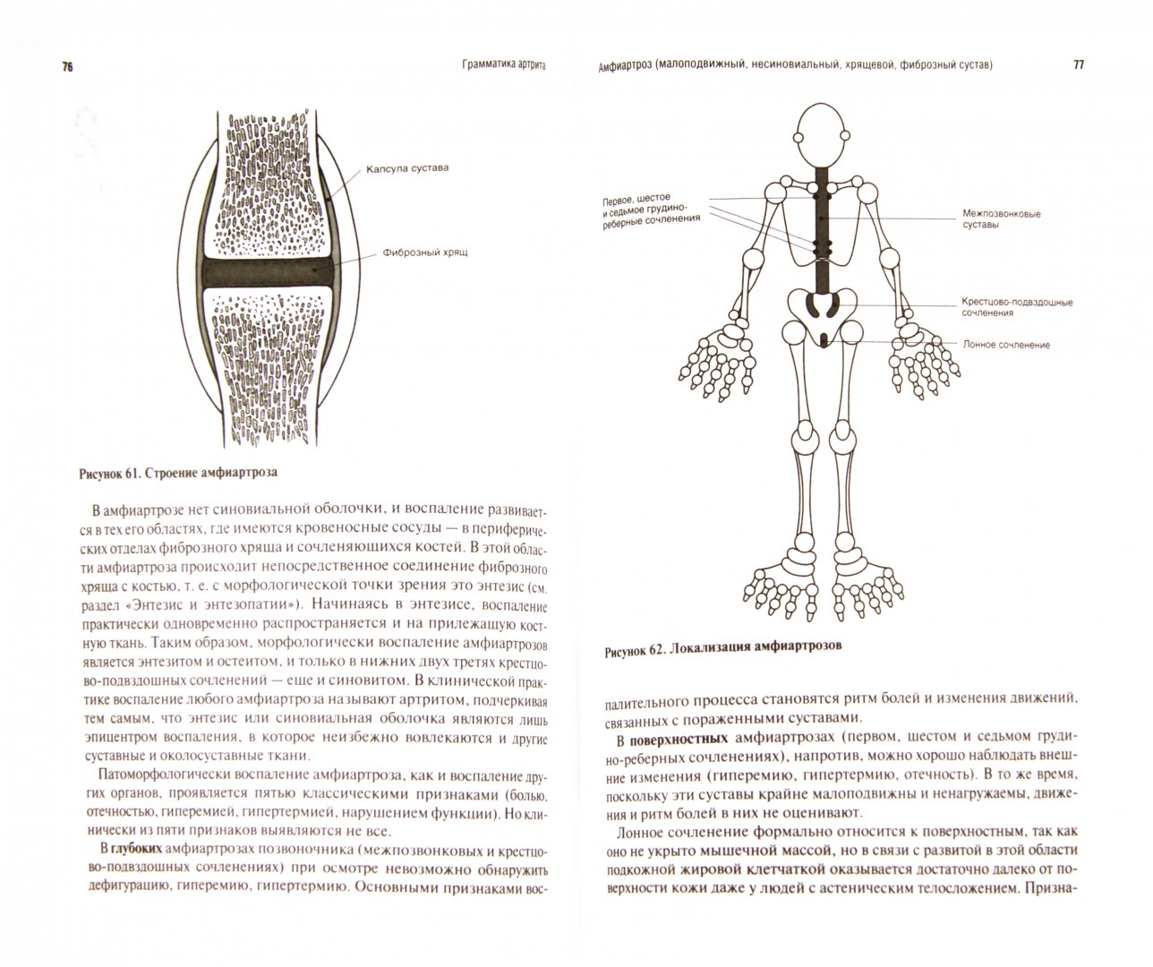 Иллюстрация 1 из 9 для Грамматика артрита - Сторожаков, Лялина | Лабиринт - книги. Источник: Лабиринт