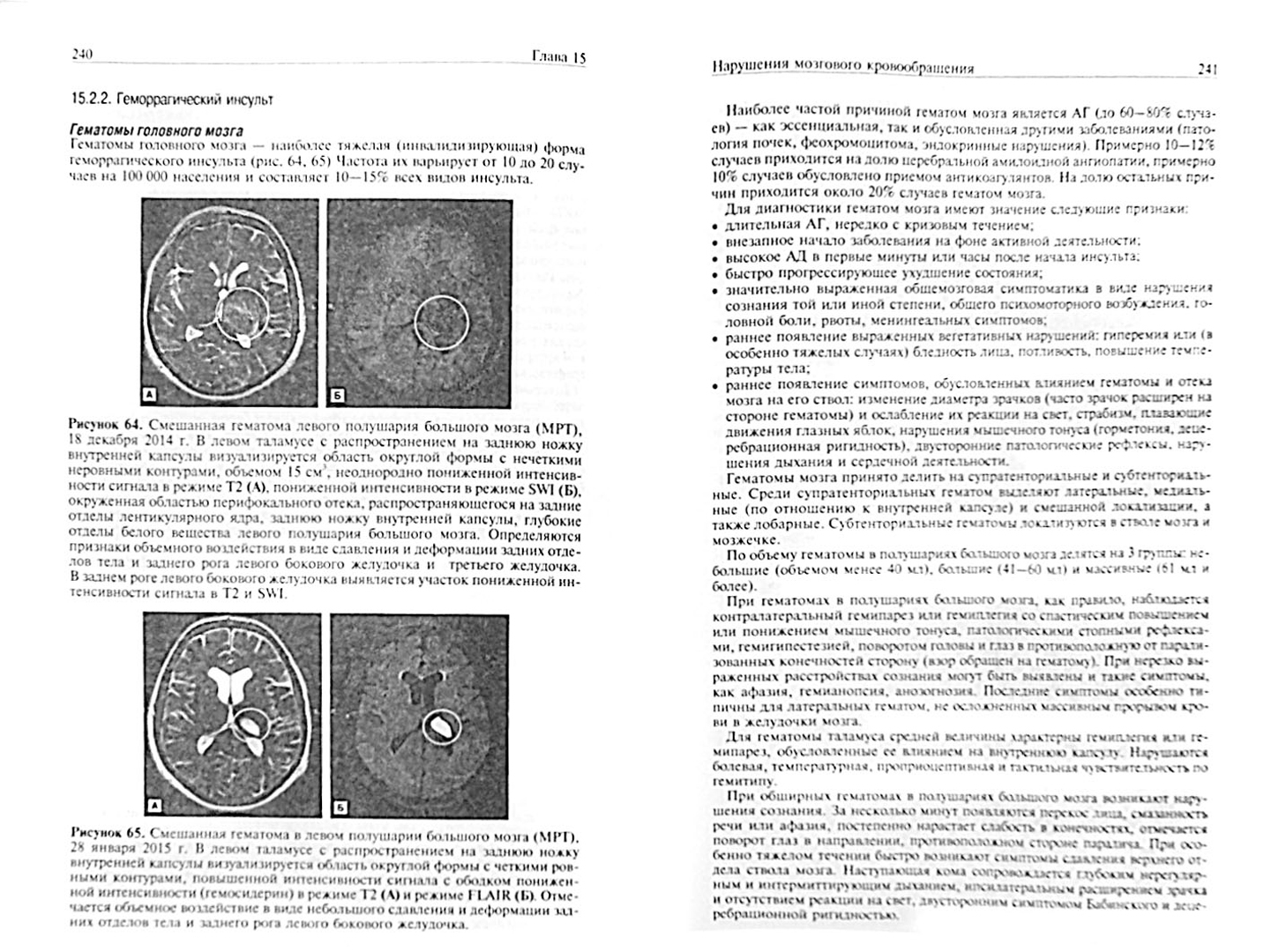 Иллюстрация 1 из 9 для Неврология. Учебник - Суслина, Максимова, Пирадов | Лабиринт - книги. Источник: Лабиринт