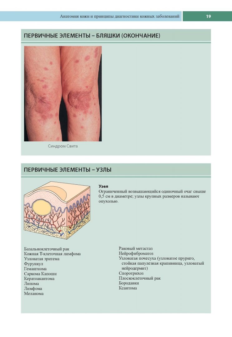 Иллюстрация 9 из 25 для Клиническая дерматология. Аллергические дерматозы - Томас Хэбиф | Лабиринт - книги. Источник: Лабиринт