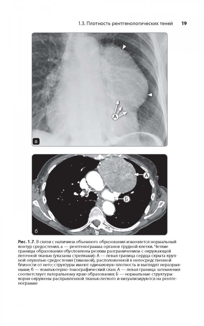 Иллюстрация 9 из 22 для Клиническая интерпретация рентгенограммы легких - Дарби, Эди, Чендрейтриа | Лабиринт - книги. Источник: Лабиринт