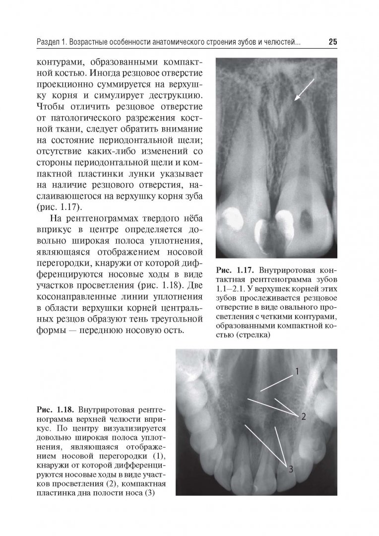Иллюстрация 14 из 24 для Рентгеноанатомия и рентгенодиагностика в стоматологии - Виктор Трутень | Лабиринт - книги. Источник: Лабиринт