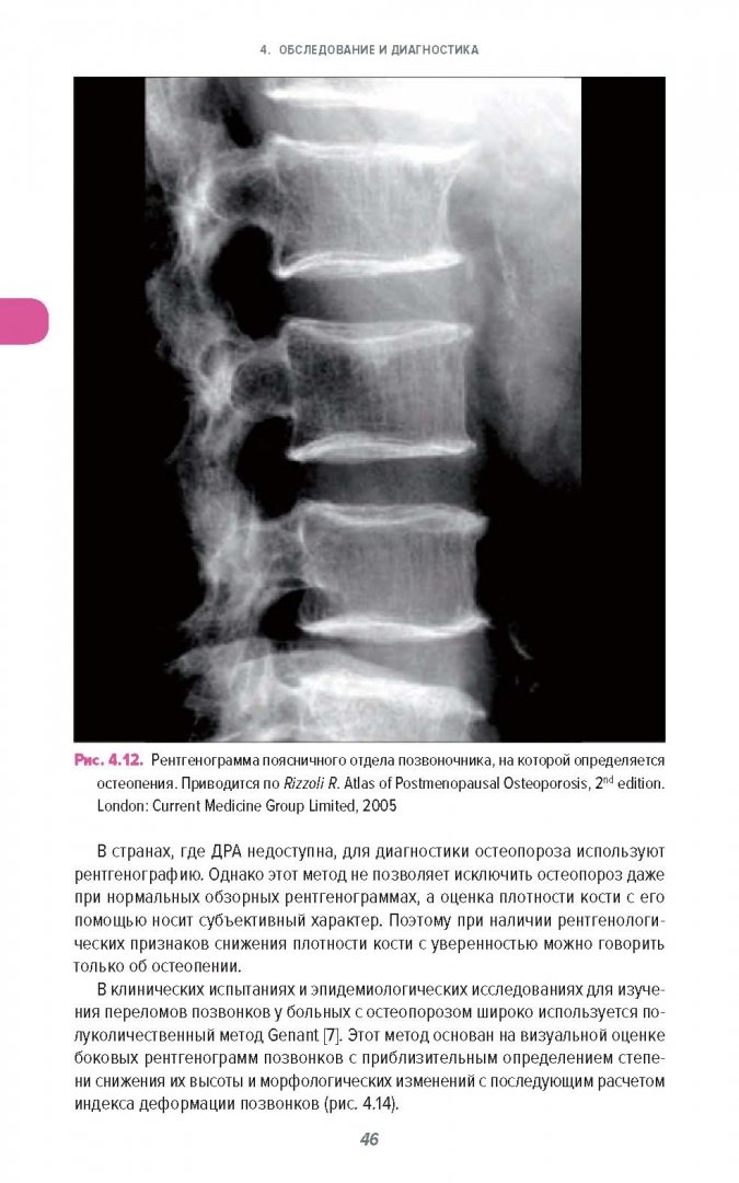 Иллюстрация 5 из 16 для Справочник по остеопорозу - Давид Рэйд | Лабиринт - книги. Источник: Лабиринт