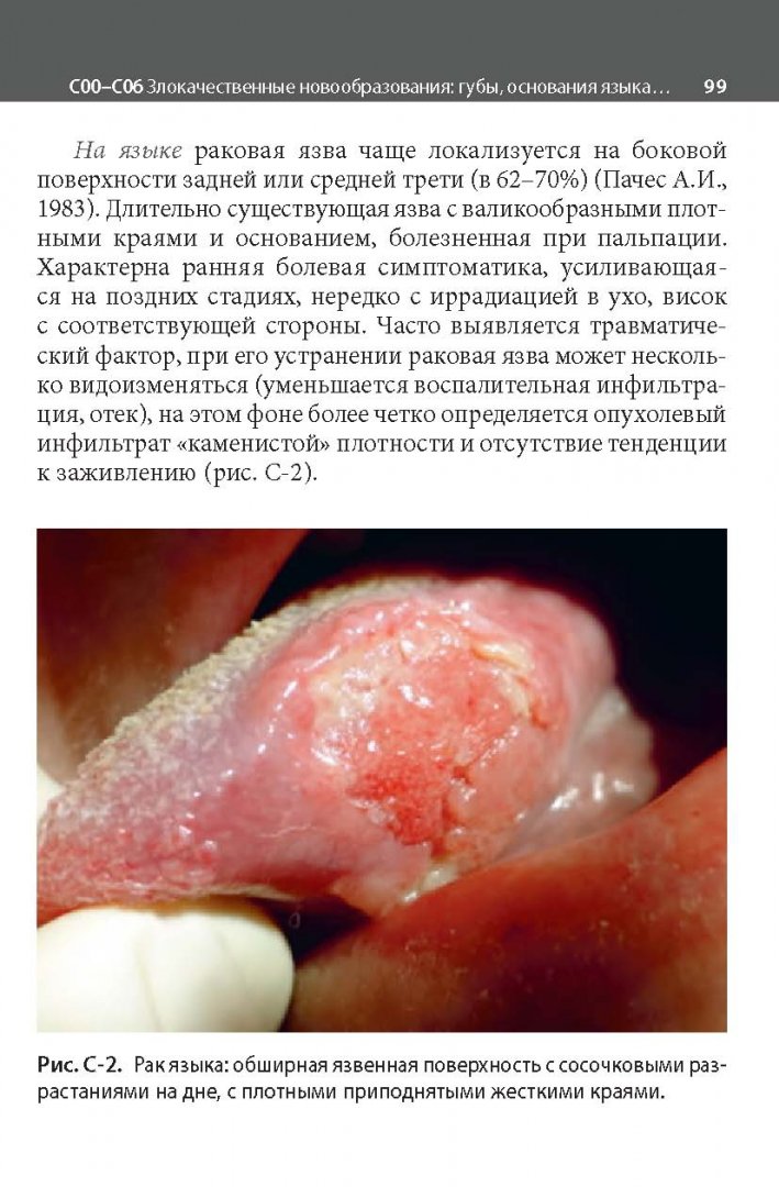 Иллюстрация 13 из 17 для Заболевания слизистой оболочки рта. Связь с общей патологией. Диагностика. Лечение - Аксамит, Цветкова | Лабиринт - книги. Источник: Лабиринт
