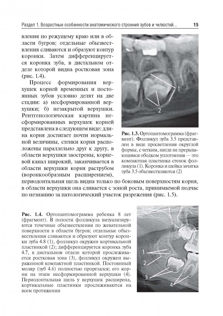 Иллюстрация 7 из 24 для Рентгеноанатомия и рентгенодиагностика в стоматологии - Виктор Трутень | Лабиринт - книги. Источник: Лабиринт
