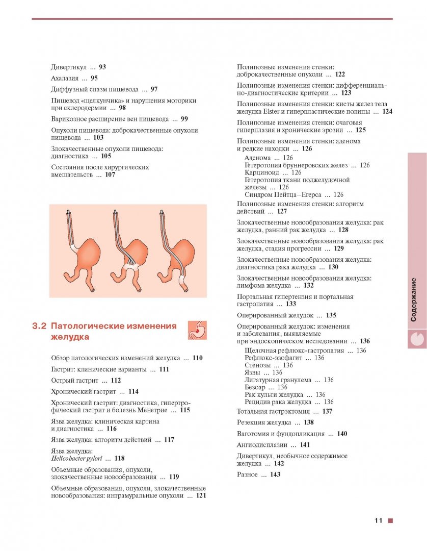 Иллюстрация 2 из 20 для Гастроскопия - Блок, Шахшаль, Шмидт | Лабиринт - книги. Источник: Лабиринт