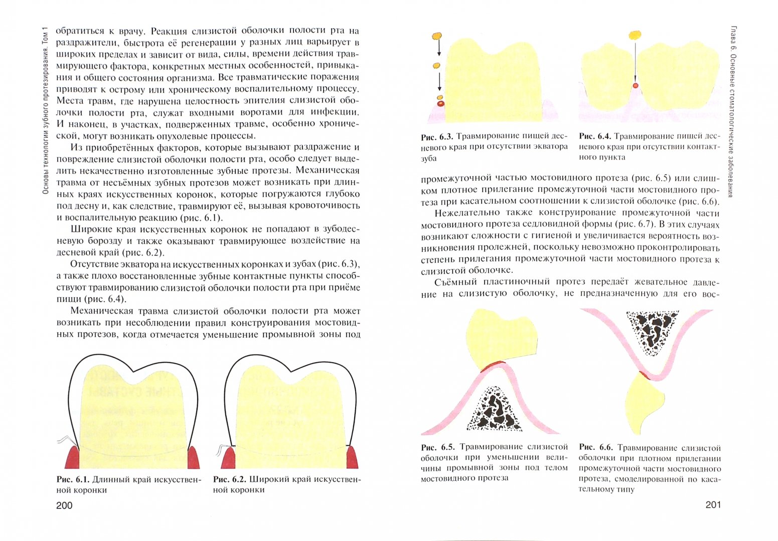 Иллюстрация 1 из 15 для Основы технологии зубного протезирования. Учебник в 2-х томах. Том 1 - Каливраджиян, Абакаров, Бобешко | Лабиринт - книги. Источник: Лабиринт