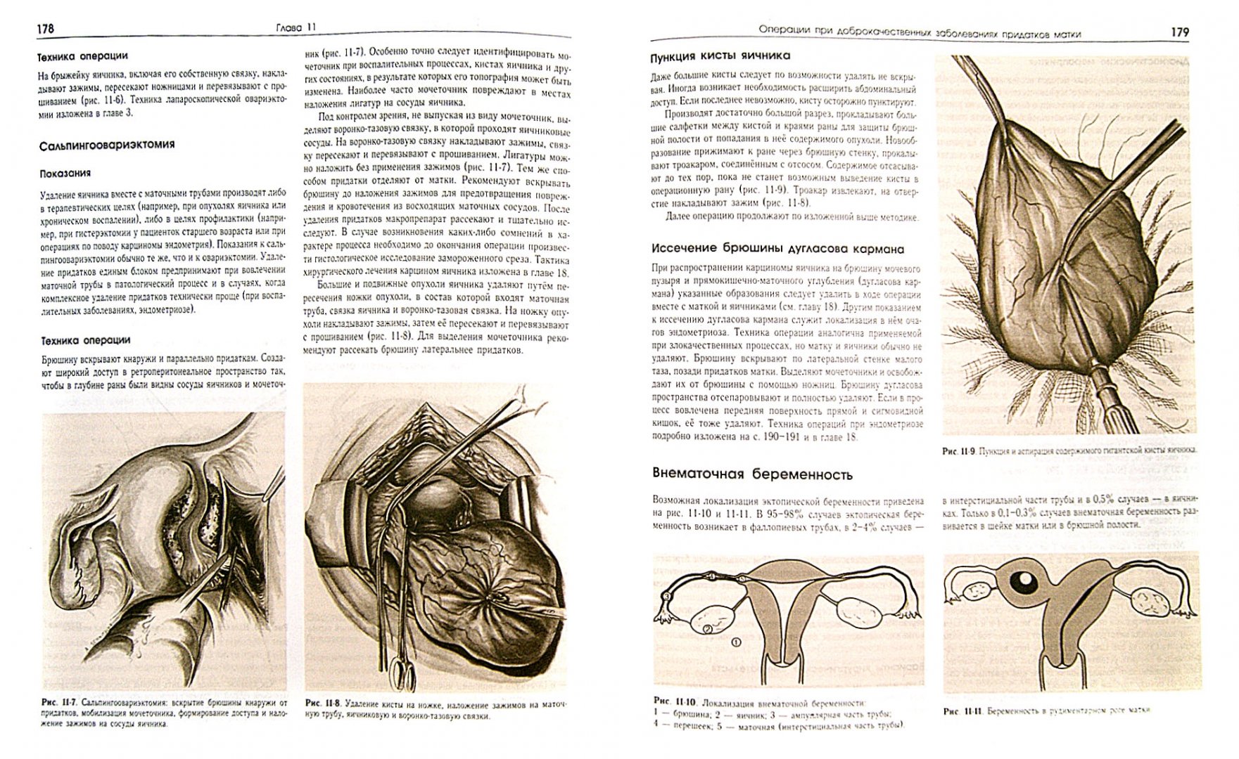 Иллюстрация 1 из 8 для Оперативная гинекология. Атлас - Хирш, Кезер, Икле | Лабиринт - книги. Источник: Лабиринт