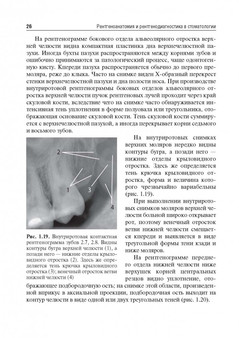 Иллюстрация 15 из 24 для Рентгеноанатомия и рентгенодиагностика в стоматологии - Виктор Трутень | Лабиринт - книги. Источник: Лабиринт