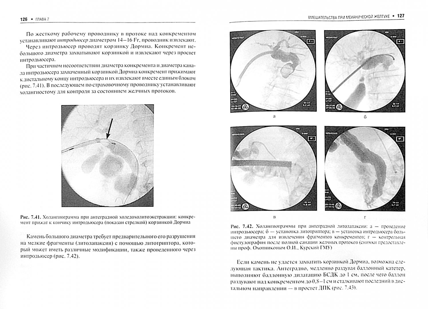 Иллюстрация 1 из 5 для Чрескожные вмешательства в абдоминальной хирургии - Кулезнева, Израилов, Мусаев | Лабиринт - книги. Источник: Лабиринт