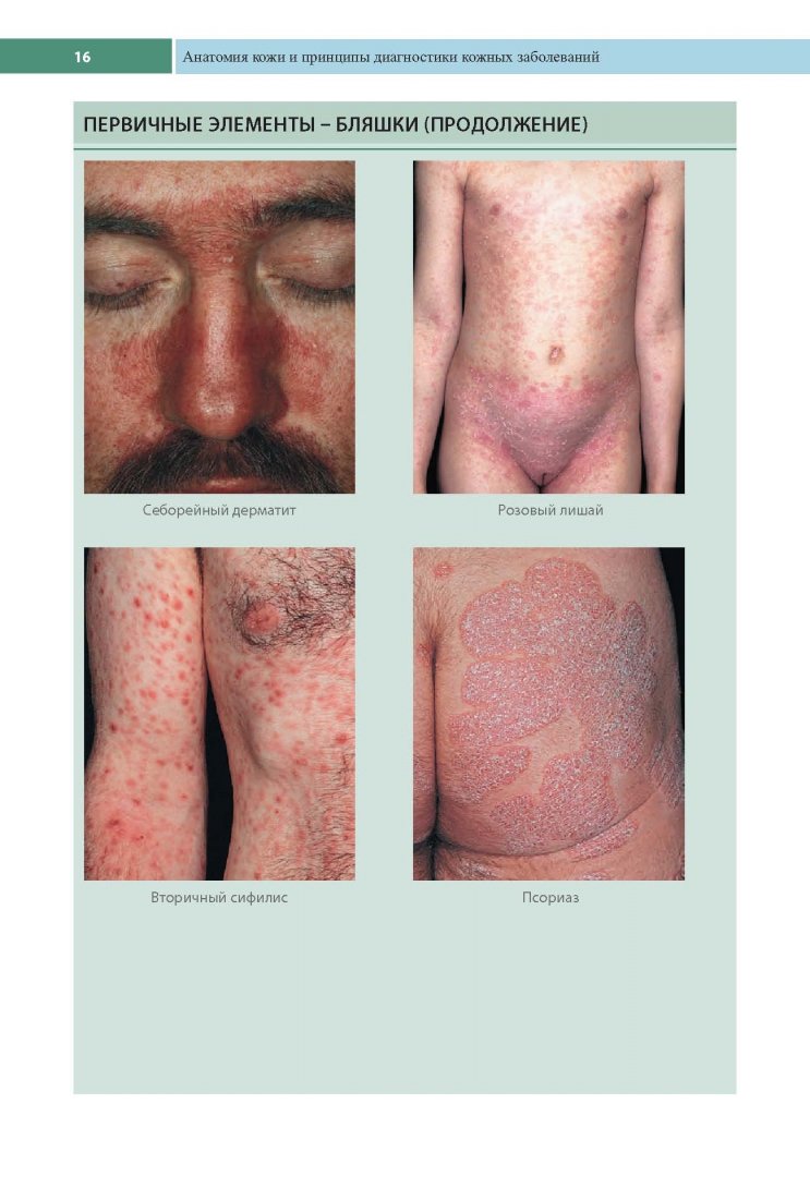 Иллюстрация 7 из 25 для Клиническая дерматология. Аллергические дерматозы - Томас Хэбиф | Лабиринт - книги. Источник: Лабиринт