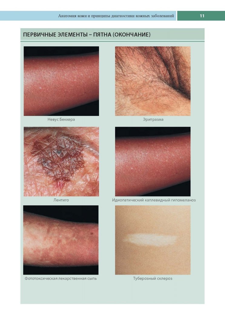 Иллюстрация 3 из 25 для Клиническая дерматология. Аллергические дерматозы - Томас Хэбиф | Лабиринт - книги. Источник: Лабиринт