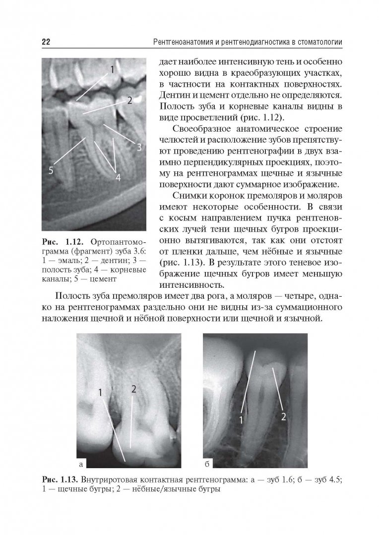 Иллюстрация 13 из 24 для Рентгеноанатомия и рентгенодиагностика в стоматологии - Виктор Трутень | Лабиринт - книги. Источник: Лабиринт