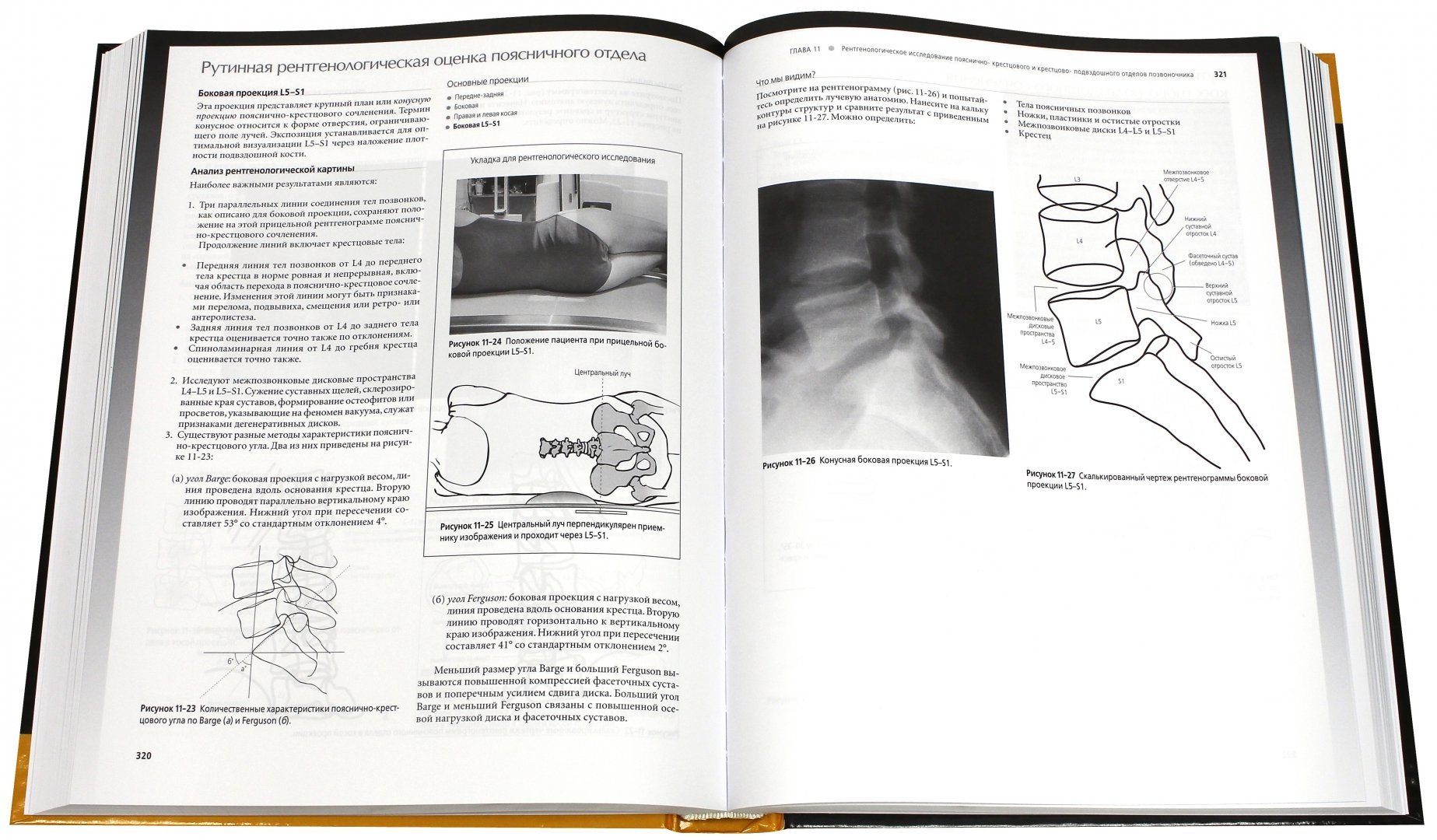 Иллюстрация 1 из 5 для Лучевая диагностика в травматологии и ортопедии. Клиническое руководство - Линн Маккиннис | Лабиринт - книги. Источник: Лабиринт