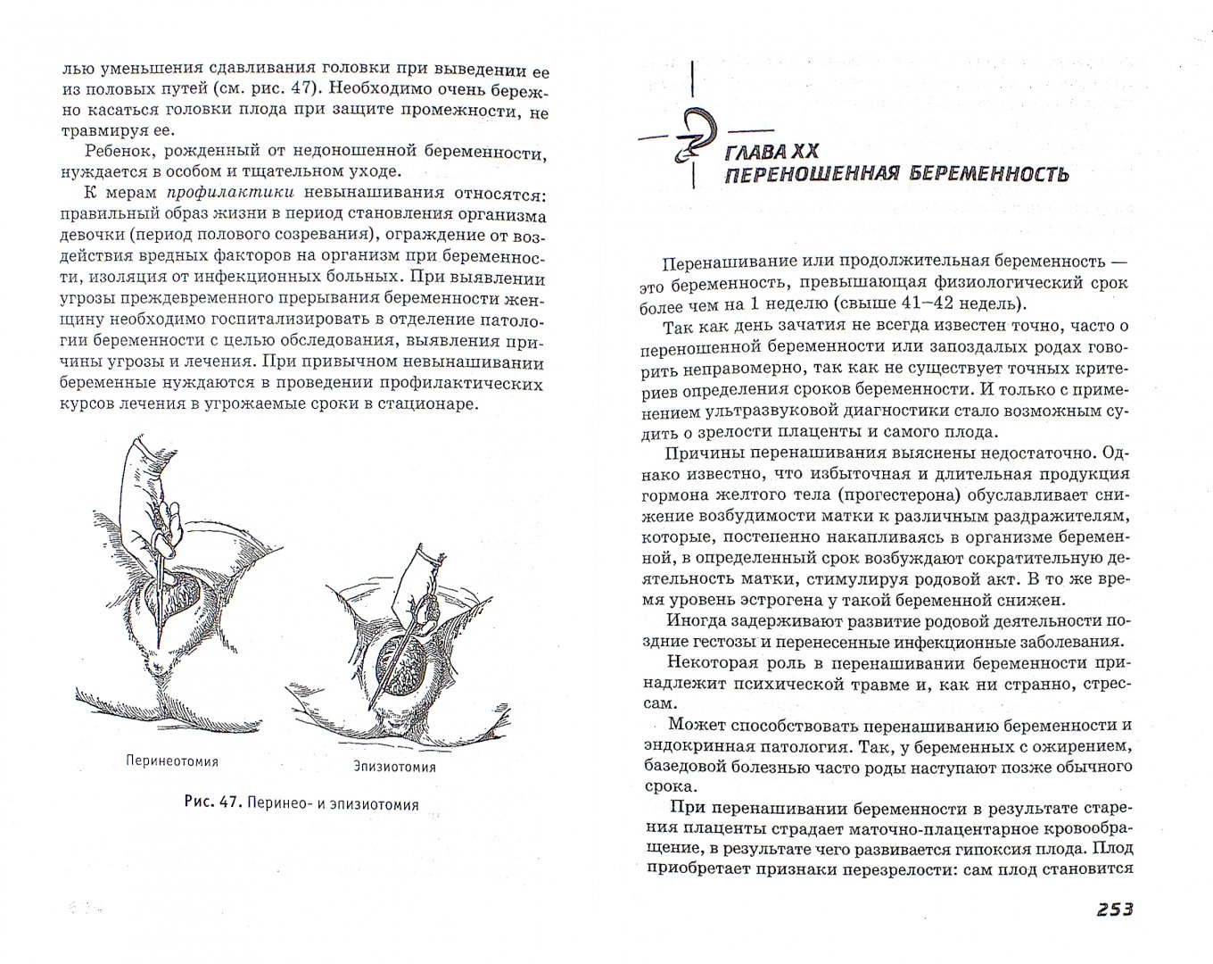Иллюстрация 1 из 9 для Акушерство и гинекология. Учебник - Изабелла Славянова | Лабиринт - книги. Источник: Лабиринт