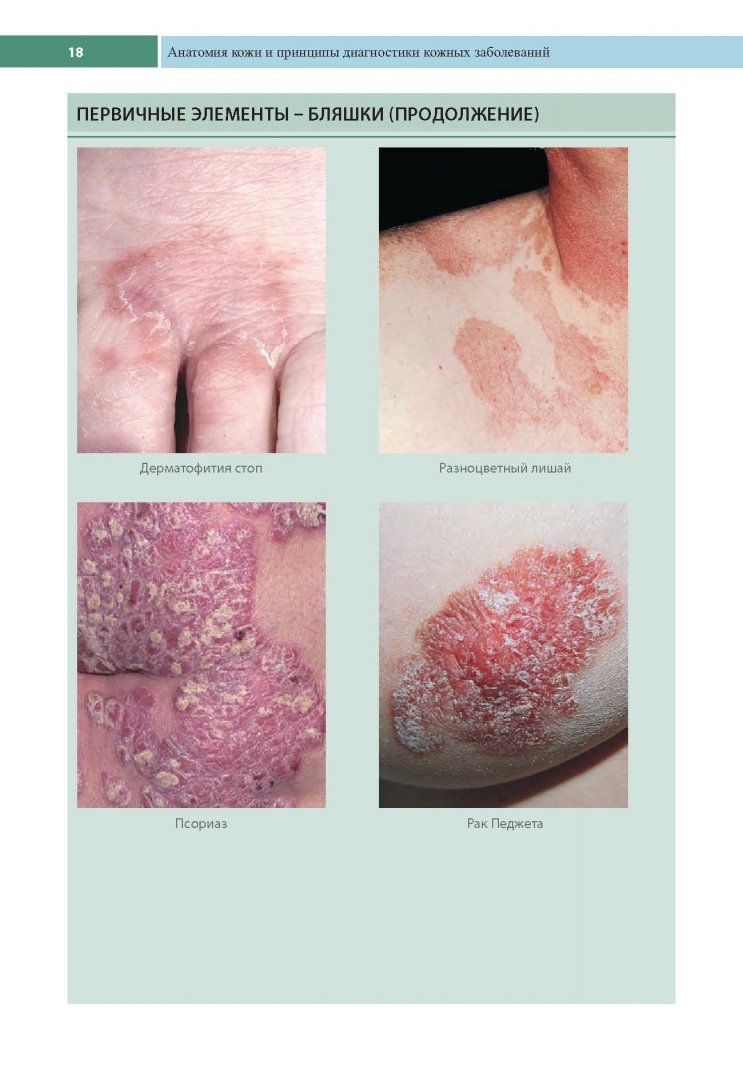 Иллюстрация 8 из 25 для Клиническая дерматология. Аллергические дерматозы - Томас Хэбиф | Лабиринт - книги. Источник: Лабиринт