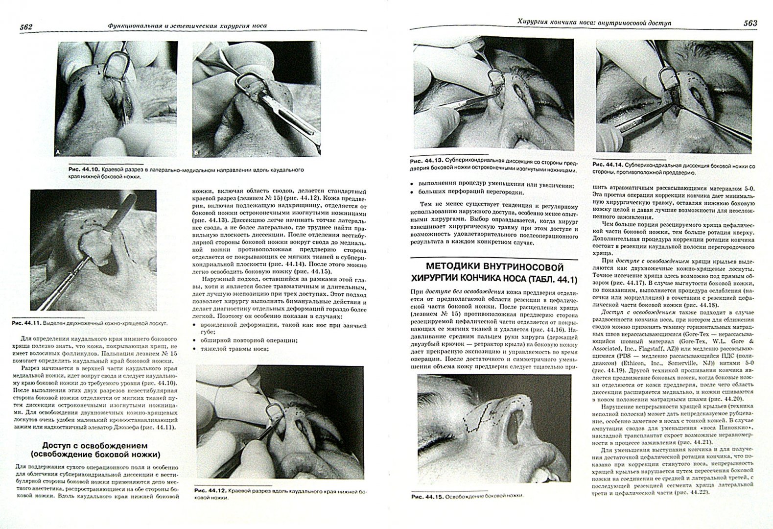 Иллюстрация 1 из 16 для Пластическая и реконструктивная хирургия лица - Пейпл, Фродел, Холт | Лабиринт - книги. Источник: Лабиринт